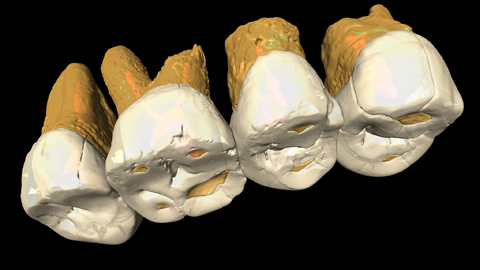 An diesen Zähnen - hier ein Bild im CT-Scan - erkannten Forscher die neue Menschenart Homo luzonensis